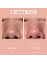 ビューティブロス(Beauty Bros)/