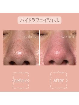 ビューティブロス(Beauty Bros)/