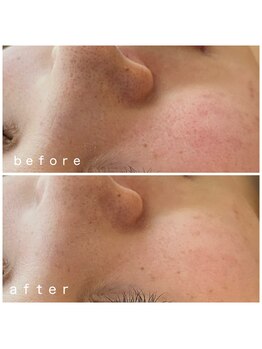 メナードフェイシャルサロン 岐阜茜部/うるおい/毛穴ケア/モイスト