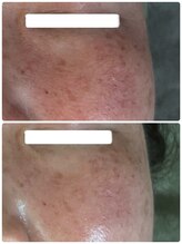 ビジュープラス 幸手店(Bijou+)/スタンダート（オプションなし）