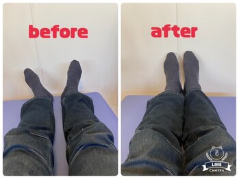 ひがし接骨院/骨盤矯正【つくば市】