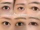 エトワボーテ(Et toi beaute)の写真