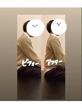 おはな整骨院 光の森院/猫背矯正　ビフォーアフター！