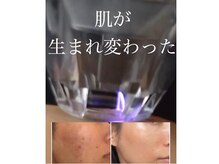 シミ＊シワにお肌の奥までしっかり届ける新ケア【鎌倉】