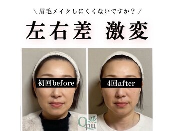 キュープ 高崎店(Qpu)/小顔頭蓋骨矯正＋リンパケア
