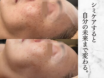 リボーン 柏(REBORN)/エアインジェクションで肌が輝く