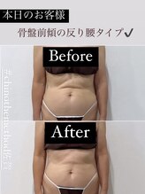 ソルヴィス(SOLVIS)/