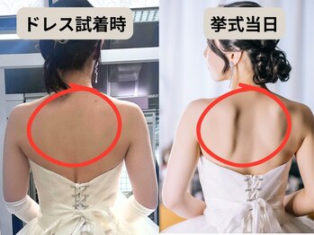 優子さんの美容矯正サロン/練馬のブライダルエステ（背中）