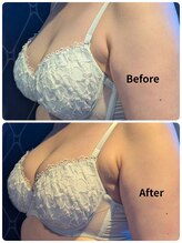 ククナ 上越店(KUKUNA)/★バストアップビフォーアフター