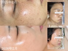 リトルーム(Litroom: from Seoul)の雰囲気（透明感が溢れている1年間で一目瞭然の変化）