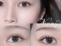 ナポーラ(NAPORA)