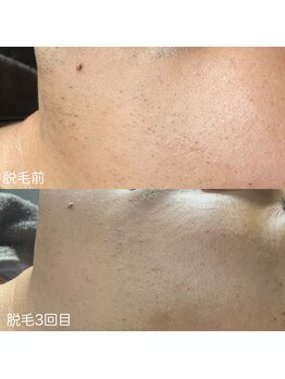 ア レーズ(a laise)/メンズにもオススメ☆