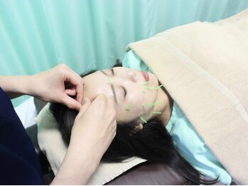 まちだ駅前鍼灸院 整骨院/ベテランスタッフの鍼灸施術