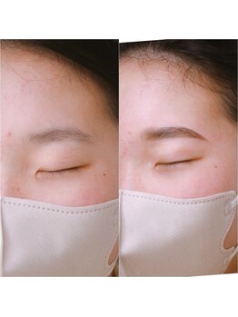 フェザー(feather)/