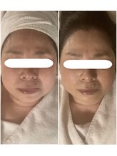 カラーリリー(calla lily)/ウルトラリフトプレミアム