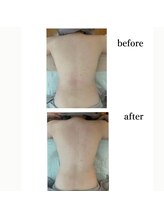 アンドスロウ(&slow)/リンパマッサージ(ゆるかっさ)