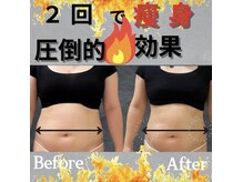 ラフィール/二の腕・背中のハミ肉ケアしたい