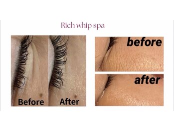 ドットフェイス(.Face)/before/after