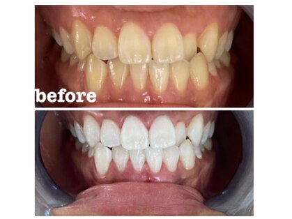 エクシアホワイトニング 西宮北口店の写真