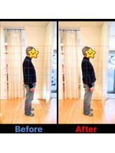 のと整体 金沢本院/一回で姿勢が矯正されます