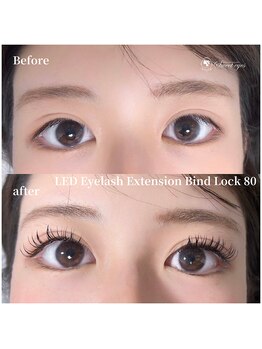 スウィートアイズ(Sweet eyes)/LEDバインドロック80束