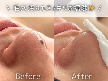 フェイシャルヴィム(FACIAL VIM)/皮脂汚れも水素でお掃除