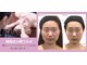 小顔フェイスラボ 大津京駅前店(小顔 Face Labo.)の写真