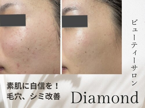ダイヤモンド(Diamond)｜ホットペッパービューティー