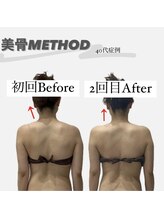 ソルヴィス(SOLVIS)/