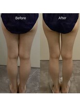 ベレピ(belepi)/太ももの隙間も爆誕！