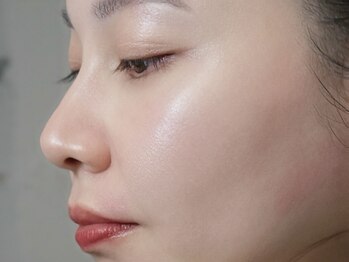 アイロンボーイ(IRONBOY)の写真/産毛とともに、毛穴の汚れも除去!セルフケアでは難しい「産毛」によるお肌のお悩み改善◎