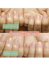 マニエネイル(mani e nail)/深爪矯正&上質ネイルケア