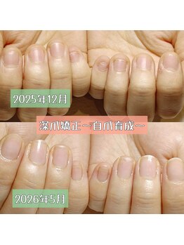 マニエネイル(mani e nail)/深爪矯正&上質ネイルケア
