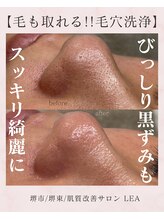 レア(Lea)/黒ずみもしっかり改善
