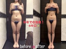 メディカルエステサロン ローズ 福井高柳店(ROSE)