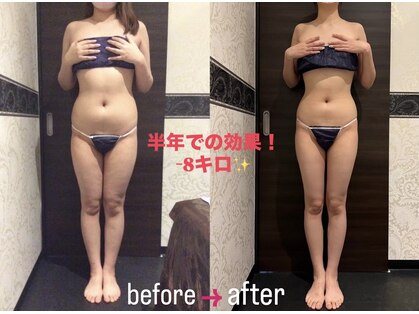 メディカルエステサロン ローズ 福井高柳店(ROSE)の写真
