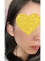 ヴィ ボーテ(Vie beaute) Vie beauteのお手入れで理想的なフェイスラインになりました☆