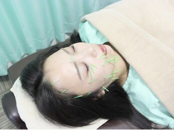 まちだ駅前鍼灸院 整骨院/美容鍼＋パックのセットもご用意