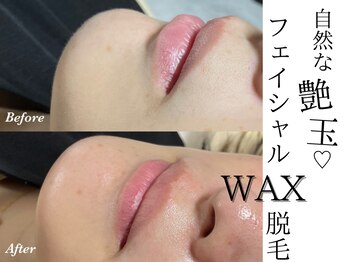 テテ(TeTe)/フェイシャルワックス脱毛