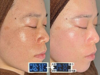 ルーナジェーナ(Luna llena)/池袋　エステ　ルーナジェーナ