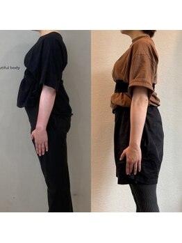 ホリック アイス コア ボディ(HOLIC ICE CORE BODY)/お客様のビフォーアフター7