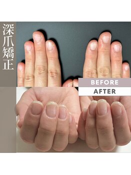 プリンチペッサジゼル/自爪育成