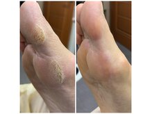 タソニ(DASONI)の雰囲気（そのタコ！ご自身でで切ってませんか？DASONIでお任せください！）