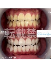 ホワイトニングサロン 熊本店/whiteningsalon kumamoto