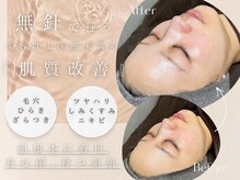 菌活フェイシャル専門店 florasKIN 恵比寿Amour店【1/7 NEW OPEN（予定）】