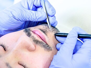 リムーブ(ReMove)/男性ひげ脱毛の様子