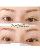 ケアフリーダム(CareFreeDom)/Citeラッシュリフト