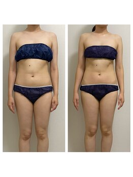 ハピネスビューティーサロン(happiness beauty salon)/WINBACK症例