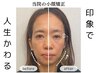 【LINE初回限定★時計の針戻しませんか?】理想の顔叶える小顔矯正¥8800