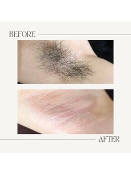 スプランドゥール(Splendeur)/レディ-ス【脇】WAX+光